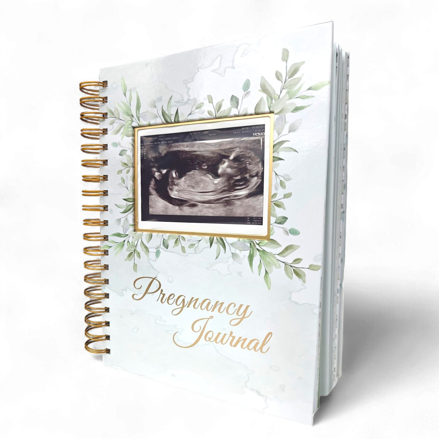 Pregnancy Journal Memory Book - Hardcover Pregnancy Book, Journals for First Time Moms, Baby Memory Book, Ultrasound Baby Memory Journal