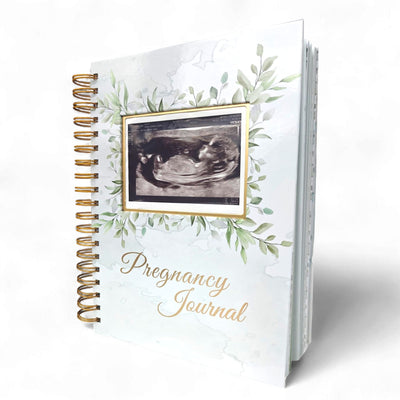 Pregnancy Journal Memory Book - Hardcover Pregnancy Book, Journals for First Time Moms, Baby Memory Book, Ultrasound Baby Memory Journal